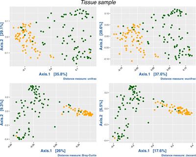 Characterization of the upper respiratory tract microbiota in Chilean asthmatic children reveals compositional, functional, and structural differences
